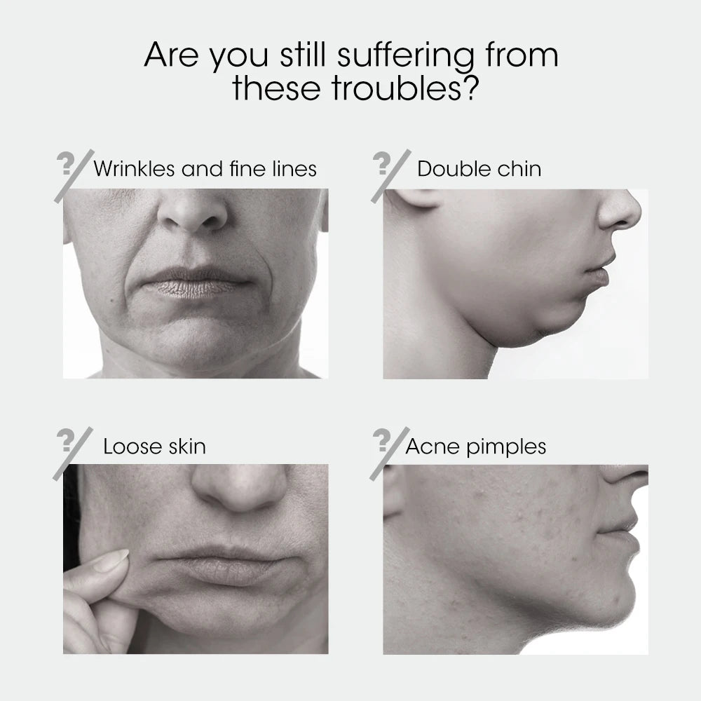Facelifting-Gerät, rotes Licht, Hautverjüngung,