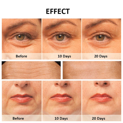 Gesichtsmassagegerät Facelifting Maschine